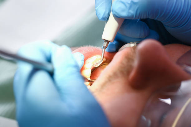 Best Emergency Care for Gum Disease in White Knoll, SC