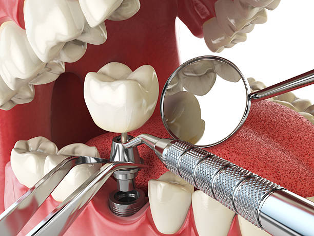 Best Emergency Dental Care for Sports Injuries in White Knoll, SC